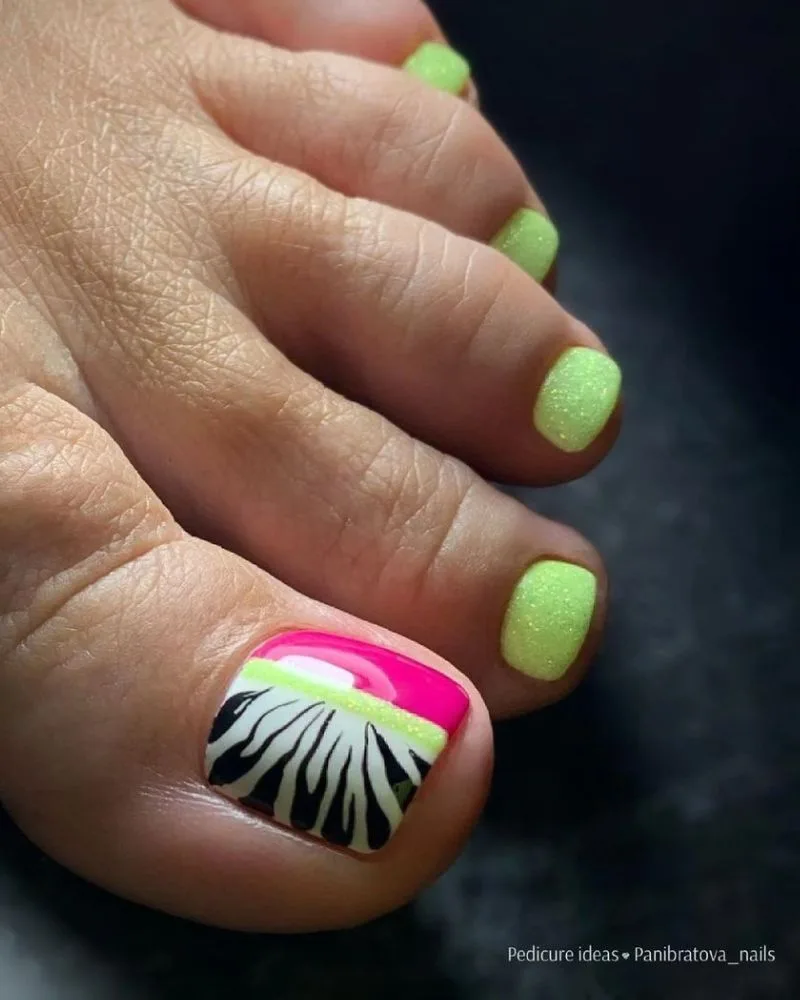 Pédicure vert lime pailleté avec accent zébré rose sur le gros orteil
