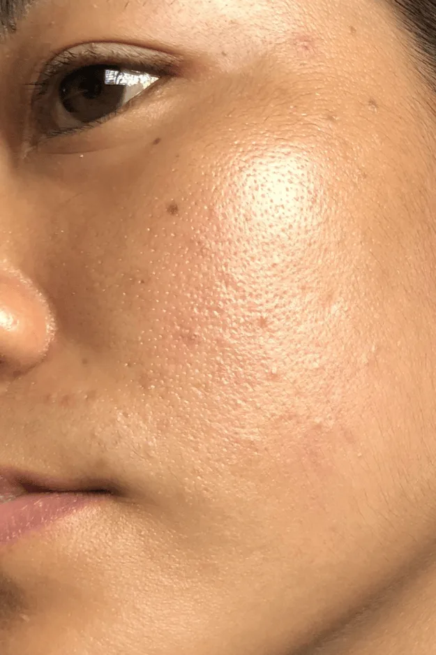 Gros plan sur la peau de la joue et du nez, grain de peau visible